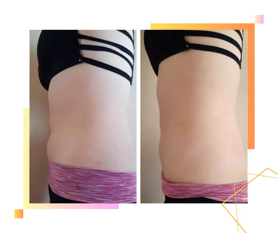 DermaOrganic™ Active Treatment — skóra przed i po terapii (2)